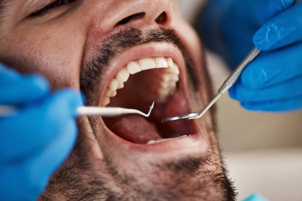 Best Emergency Treatment for Jaw Pain or Injury in Morehead City, NC
