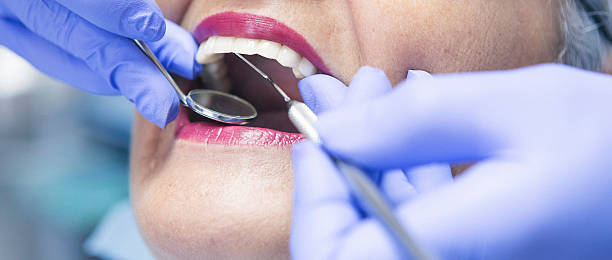 Best Emergency Denture Repair in Morehead City, NC